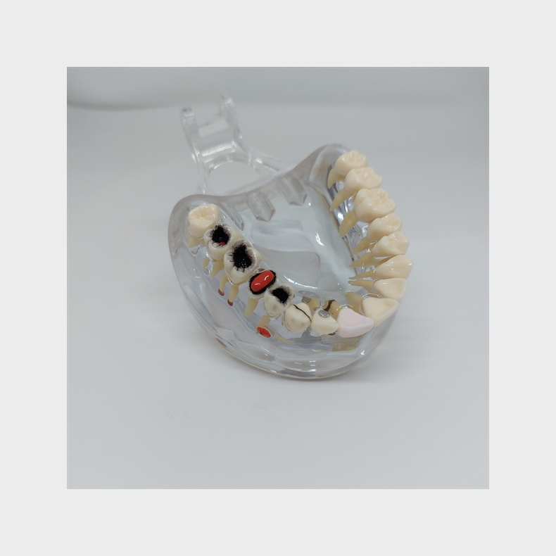 Transparent Sygdomsmodel